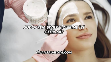 Sudocrem Sivilce İzlerine İyi Gelir mi?