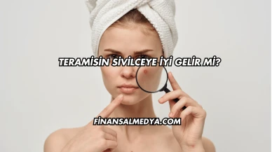 Teramisin Sivilceye İyi Gelir mi?