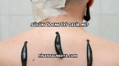 Sülük Ödeme İyi Gelir mi?