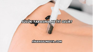 Sülük Yarasına Ne İyi Gelir?