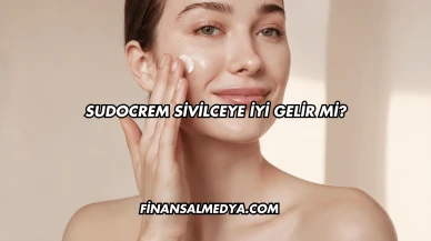Sudocrem Sivilceye İyi Gelir mi?