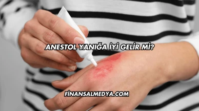 Anestol Yanığa İyi Gelir mi?