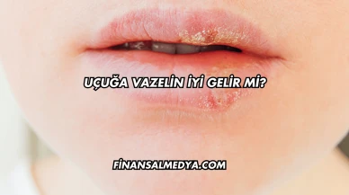 Uçuğa Vazelin İyi Gelir mi?
