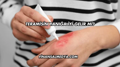 Teramisin Yanığa İyi Gelir mi?