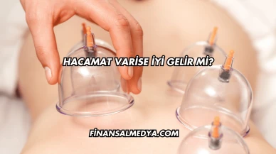 Hacamat Varise İyi Gelir mi?
