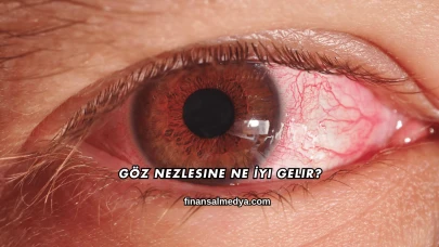 Göz Nezlesine Ne İyi Gelir?