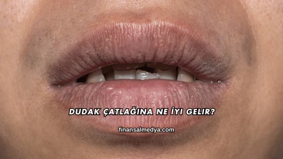 Dudak Çatlağına Ne İyi Gelir?