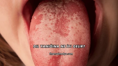 Dil Yanığına Ne İyi Gelir?