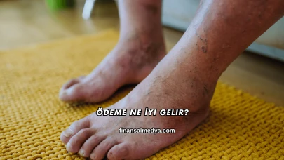 Ödeme Ne İyi Gelir?