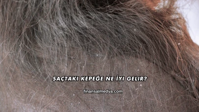 Saçtaki Kepeğe Ne İyi Gelir?