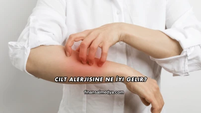 Cilt Alerjisine Ne İyi Gelir?