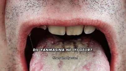 Dil Yanmasına Ne İyi Gelir?