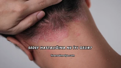 Sedef Hastalığına Ne İyi Gelir?