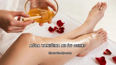 Ağda Yanığına Ne İyi Gelir?