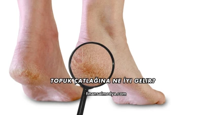Topuk Çatlağına Ne İyi Gelir?