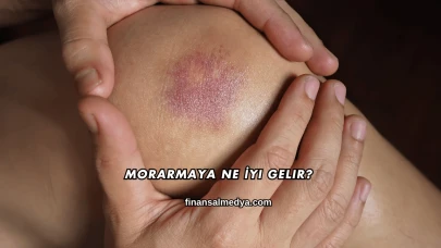 Morarmaya Ne İyi Gelir?