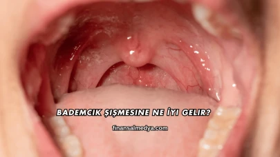 Bademcik Şişmesine Ne İyi Gelir?