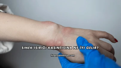 Sinek Isırığı Kaşıntısına Ne İyi Gelir?