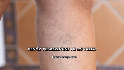 Venöz Yetmezliğine Ne İyi Gelir?