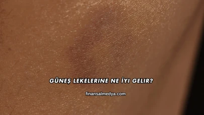 Güneş Lekelerine Ne İyi Gelir?