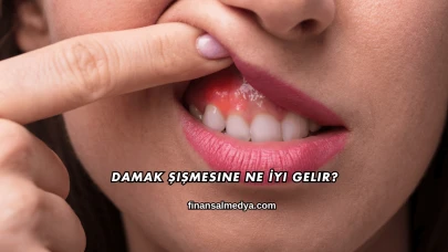 Damak Şişmesine Ne İyi Gelir?