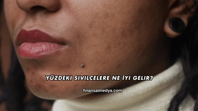 Yüzdeki Sivilcelere Ne İyi Gelir?