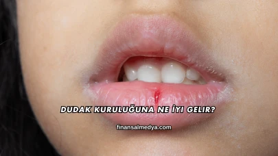 Dudak Kuruluğuna Ne İyi Gelir?
