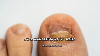 Ayak Mantarına Ne İyi Gelir?
