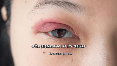 Göz Şişmesine Ne İyi Gelir?