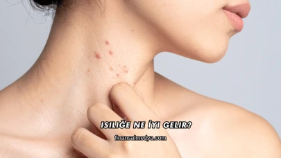 Isiliğe Ne İyi Gelir?