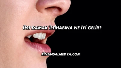 Üst Damak İltihabına Ne İyi Gelir?