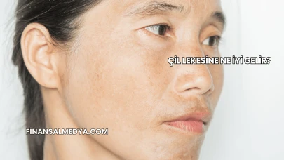 Çil Lekesine Ne İyi Gelir?