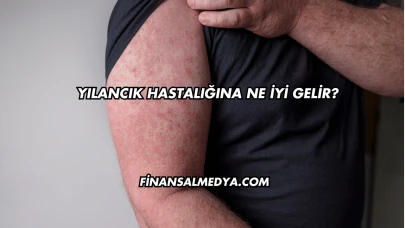 Yılancık Hastalığına Ne İyi Gelir?