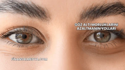 Göz Altı Morluklarını Azaltmanın Yolları