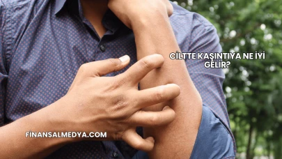 Ciltte Kaşıntıya Ne İyi Gelir?