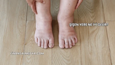 Şişen Yere Ne İyi Gelir?
