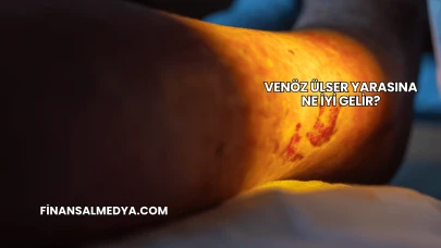 Venöz Ülser Yarasına Ne İyi Gelir?