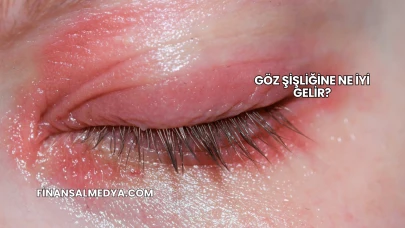 Göz Şişliğine Ne İyi Gelir?