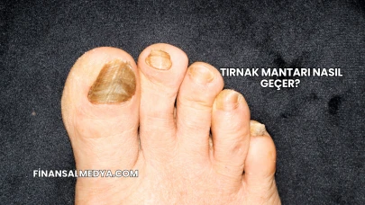 Tırnak Mantarı Nasıl Geçer?