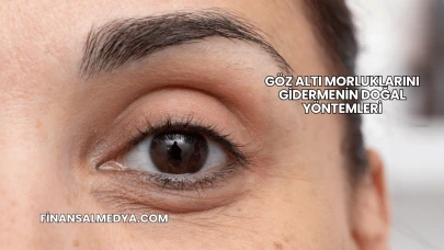 Göz Altı Morluklarını Gidermenin Doğal Yöntemleri