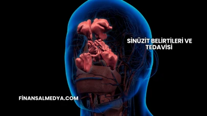 Sinüzit Belirtileri ve Tedavisi