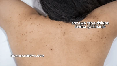 Egzama Tedavisinde Doğal Çözümler