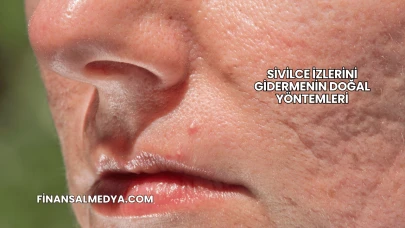 Sivilce İzlerini Gidermenin Doğal Yöntemleri