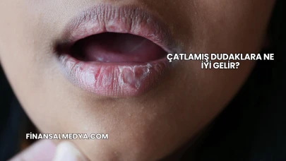 Çatlamış Dudaklara Ne İyi Gelir?