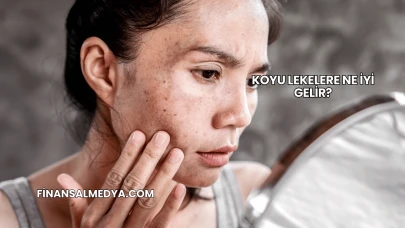 Koyu Lekelere Ne İyi Gelir?