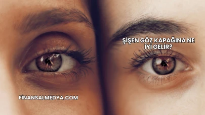 Şişen Göz Kapağına Ne İyi Gelir?