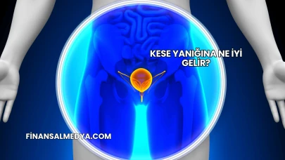 Kese Yanığına Ne İyi Gelir?