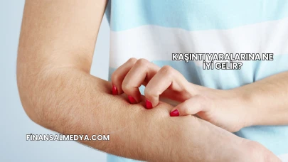 Kaşıntı Yaralarına Ne İyi Gelir?