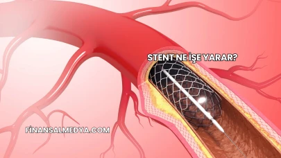 Stent Ne İşe Yarar?