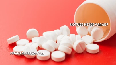 Notuss Ne İşe Yarar?